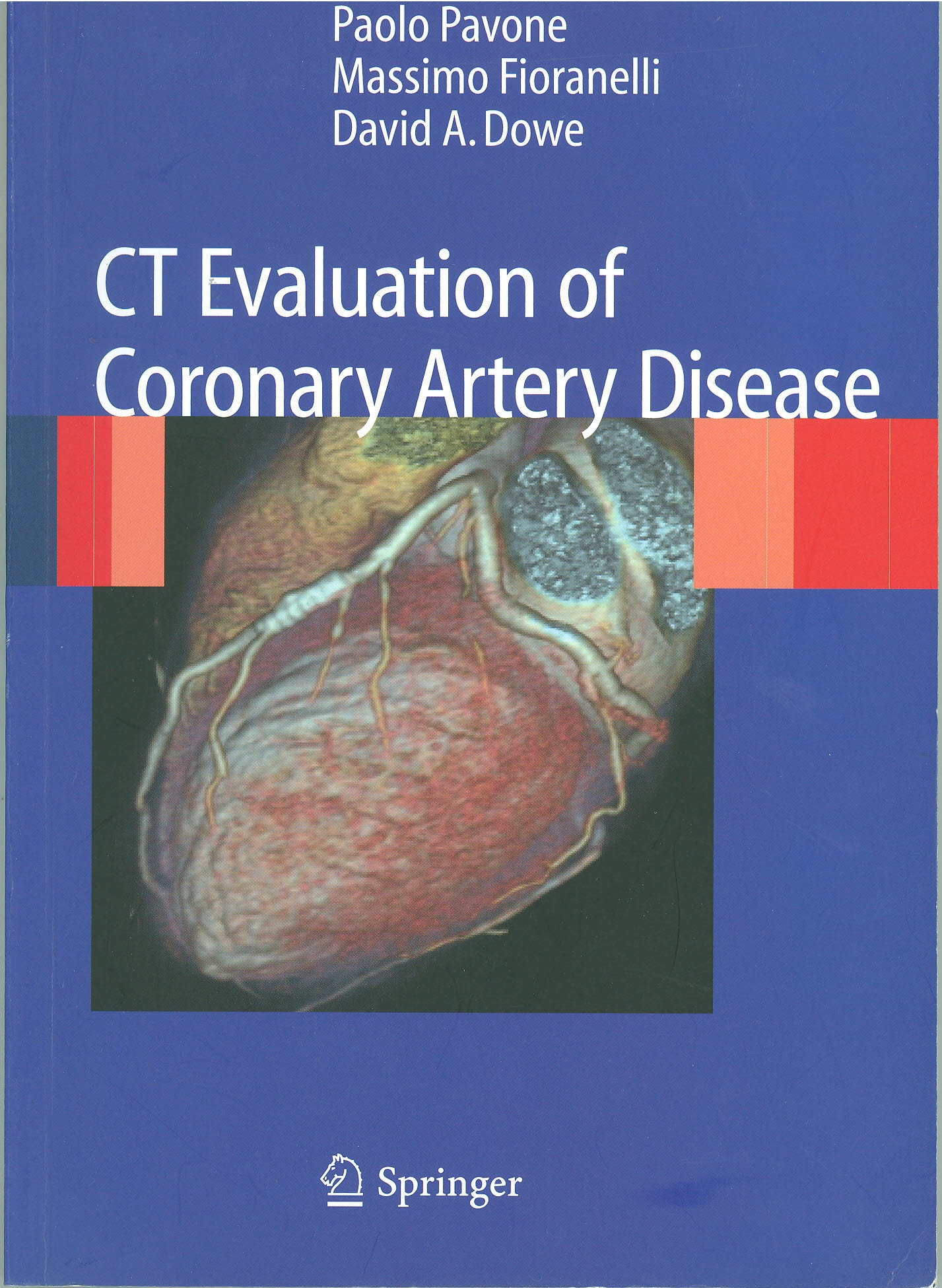 Copertina di CT Evaluation of Coronary Artery Disease