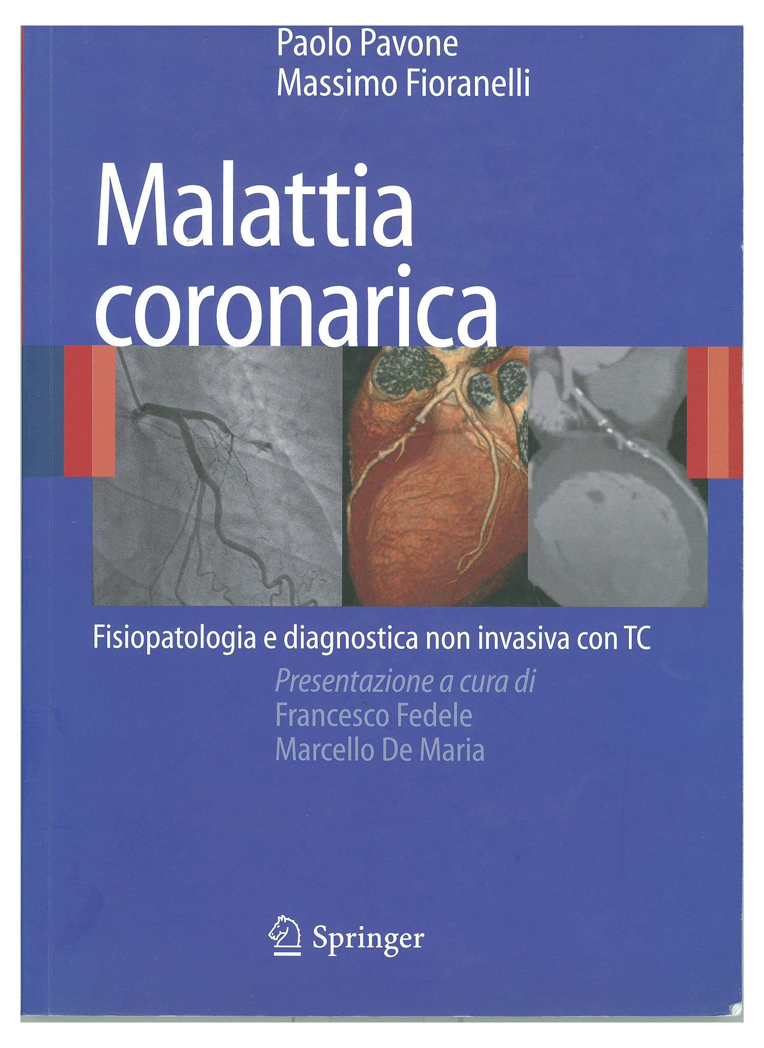 Copertina di Malattia coronarica. Fisiopatologia e diagnostica non invasiva con TC